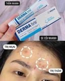 KEM Derma Forte Topical Gel 15g Hỗ Trợ Giảm Mụn, Giảm Thâm