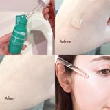 Serum Làm Dịu & Phục Hồi Da Timeless Vitamin B5 Hyaluronic Acid 30ml