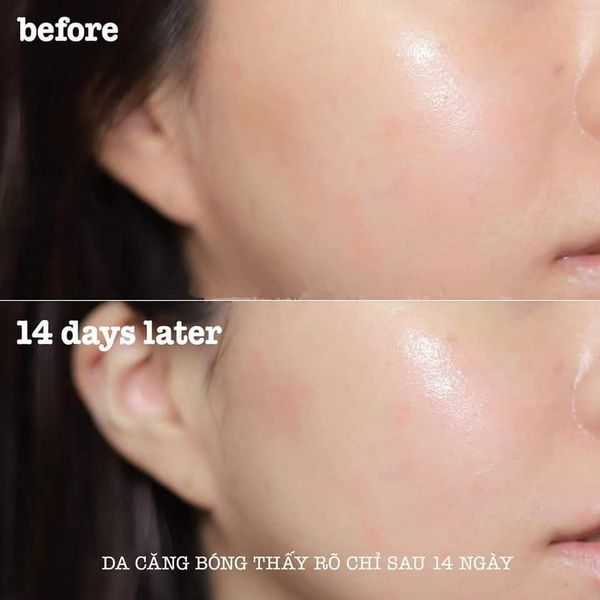 Nước Hoa Hồng Dr.Pepti Centella Toner 180ml