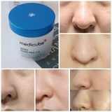 Toner Pad Medicube Super Cica - Zero Pore Pad 2.0 Pad (70 miếng)