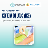  Gói xét nghiệm kiểm tra dị ứng, ngứa 