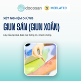  Gói xét nghiệm kiểm tra dị ứng, ngứa 