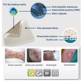  Băng gạc chống nhiễm khuẩn vết thương tiểu đường - URGOCLEAN AG 