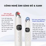 Máy Massage Chống Lão Hóa Mắt JOOU XE-19 giảm bọng mắt, nếp nhăn, quầng thâm mắt