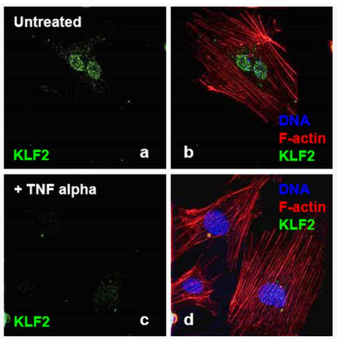 TNF Recombinant Human Protein