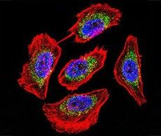 Kháng thể sơ cấp - primary antibody