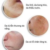  Serum B5 Pretty Skin cấp ẩm dưỡng trắng BKHEKR-9177 