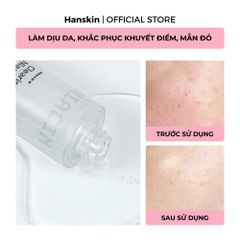 Combo Toner pad cấp ẩm làm dịu da Hanskin & Tinh Chất Dưỡng Sáng Da Hanskin Clearing Niacin Ampoule