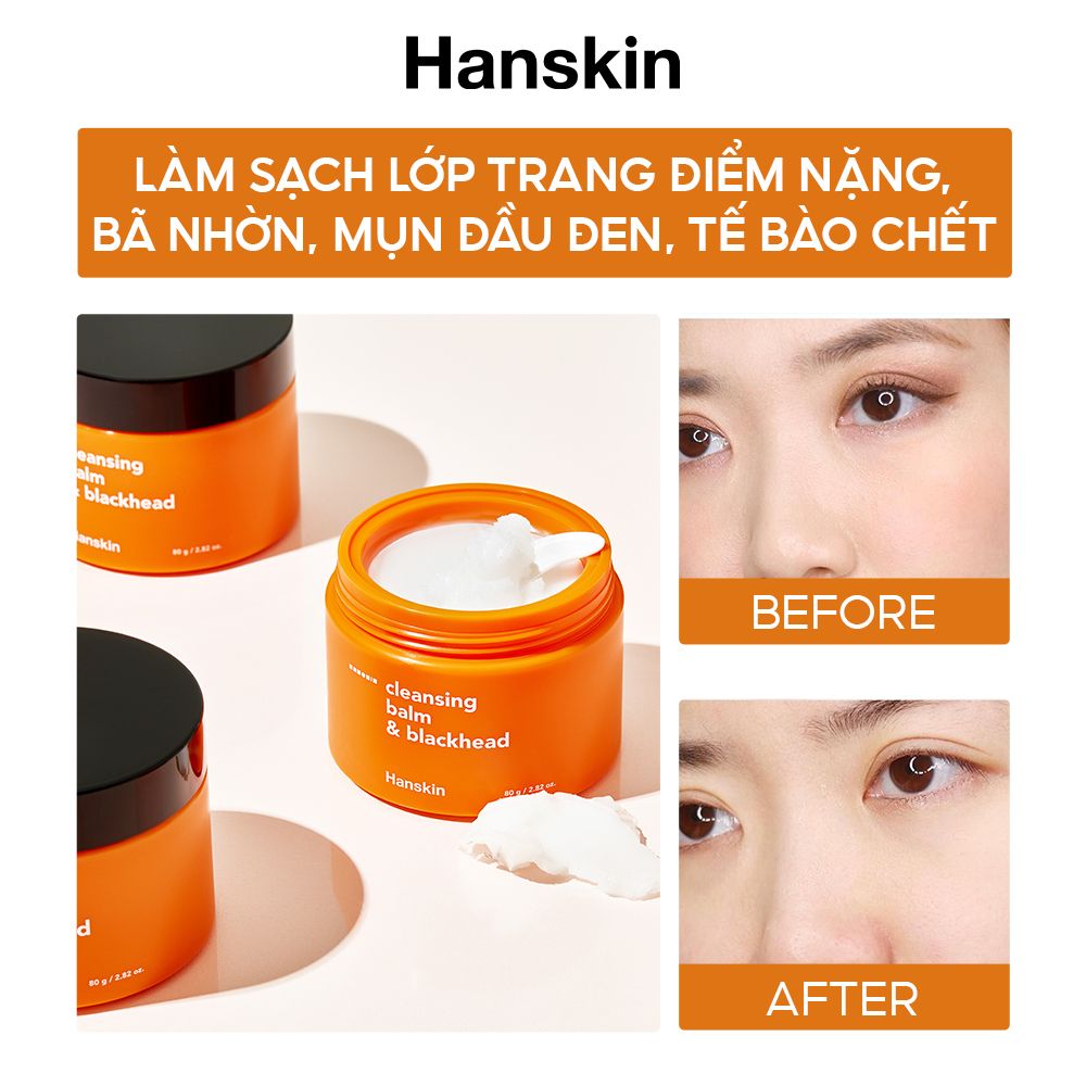 Combo Sáp Tẩy Trang Hanskin Pore Cleansing Balm AHA & Sửa Rửa Mặt Hanskin Cleansing Foam Blackhead