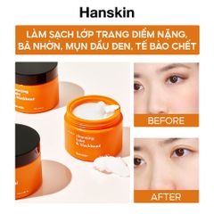 Combo Sáp Tẩy Trang Hanskin Pore Cleansing Balm AHA & Sửa Rửa Mặt Hanskin Cleansing Foam Blackhead