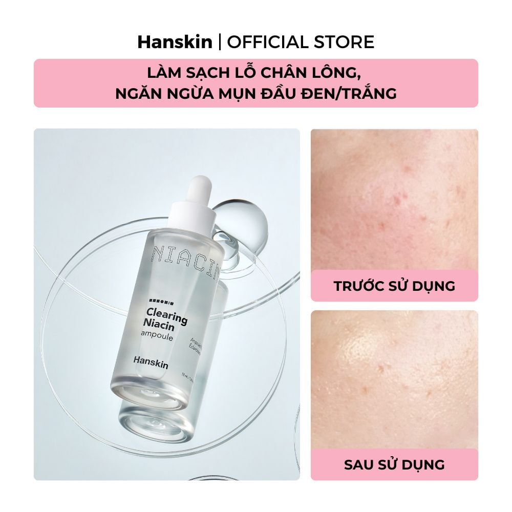 Combo Toner pad cấp ẩm làm dịu da Hanskin & Tinh Chất Dưỡng Sáng Da Hanskin Clearing Niacin Ampoule