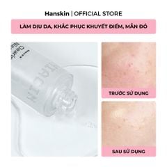 Tinh Chất Dưỡng Sáng Da Hanskin Clearing Niacin Ampoule 50ml