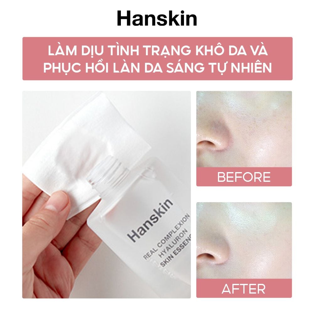 Combo Nước Hoa Hồng Hanskin 300ml & Phấn Nước Trang Điểm Hanskin Nudi-Thin Cover Cushion N01 Pure Cream