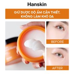 Combo Sáp Tẩy Trang Hanskin Pore Cleansing Balm AHA & Sửa Rửa Mặt Hanskin Cleansing Foam Blackhead