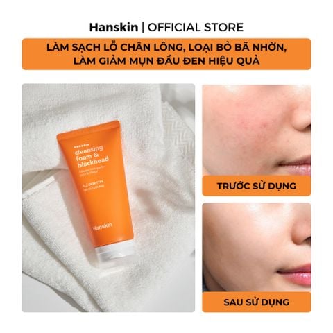 Combo Sữa Rửa Mặt Hanskin 120ml & Toner pad cấp ẩm làm dịu da Hanskin 210ml