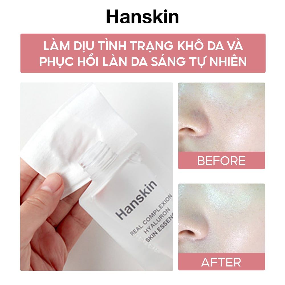 Combo Sữa rửa mặt Hanskin 120ml & Tinh Chất Dưỡng Da Hanskin 300ml