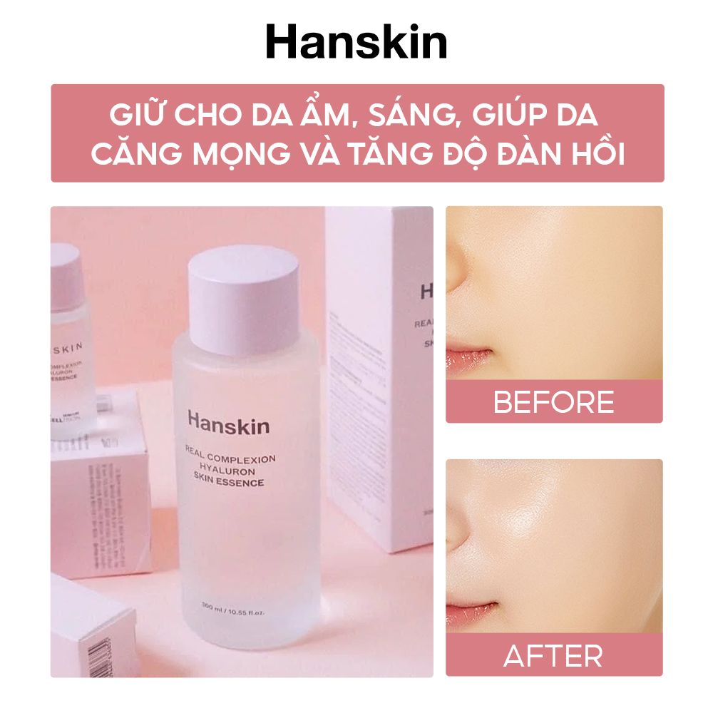 Combo Nước Hoa Hồng Hanskin 300ml & Toner Pad Cấp ẩm Hanskin 210ml