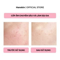 Combo Toner Pad Cấp Ẩm Làm Dịu Da Hanskin & Phấn Nước Trang Điểm Hanskin Nudi-Thin Cover Cushion N01 Pure Cream