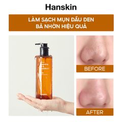 Combo Dầu Tẩy Trang Hanskin AHA/BHA/PHA 300ml & Sửa Rửa Mặt Hanskin Cleansing Foam Blackhead 120ml