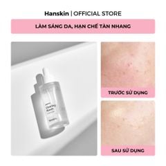 Combo Toner pad cấp ẩm làm dịu da Hanskin & Tinh Chất Dưỡng Sáng Da Hanskin Clearing Niacin Ampoule