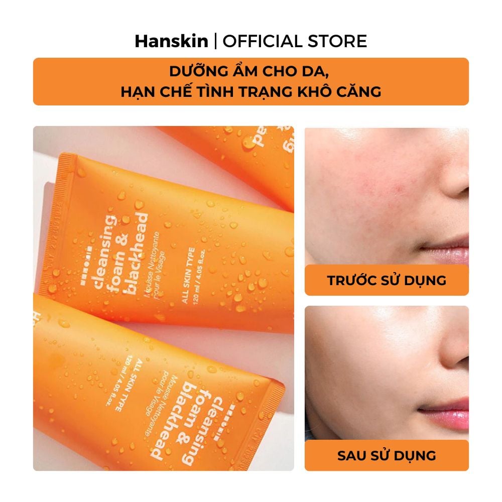 Combo Sáp Tẩy Trang Hanskin Pore Cleansing Balm AHA & Sửa Rửa Mặt Hanskin Cleansing Foam Blackhead
