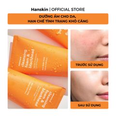 Combo Sáp Tẩy Trang Hanskin Pore Cleansing Balm AHA & Sửa Rửa Mặt Hanskin Cleansing Foam Blackhead