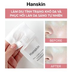 Combo Nước Hoa Hồng Hanskin 300ml & Toner Pad Cấp ẩm Hanskin 210ml