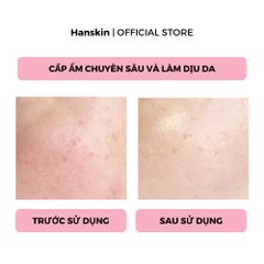 Toner pad cấp ẩm làm dịu da Hanskin Real Complexion Hyaluron Relief Toner Pad 60 Miếng/210ml