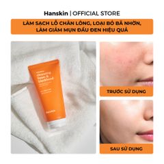 Combo Sáp Tẩy Trang Hanskin Pore Cleansing Balm AHA & Sửa Rửa Mặt Hanskin Cleansing Foam Blackhead
