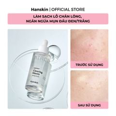 Tinh Chất Dưỡng Sáng Da Hanskin Clearing Niacin Ampoule 50ml
