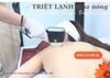 Liệu Trình Triệt Lông Lạnh