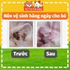 Khăn ướt lau tai cho Chó Mèo SOS, 100 miếng, vệ sinh tai sạch sẽ