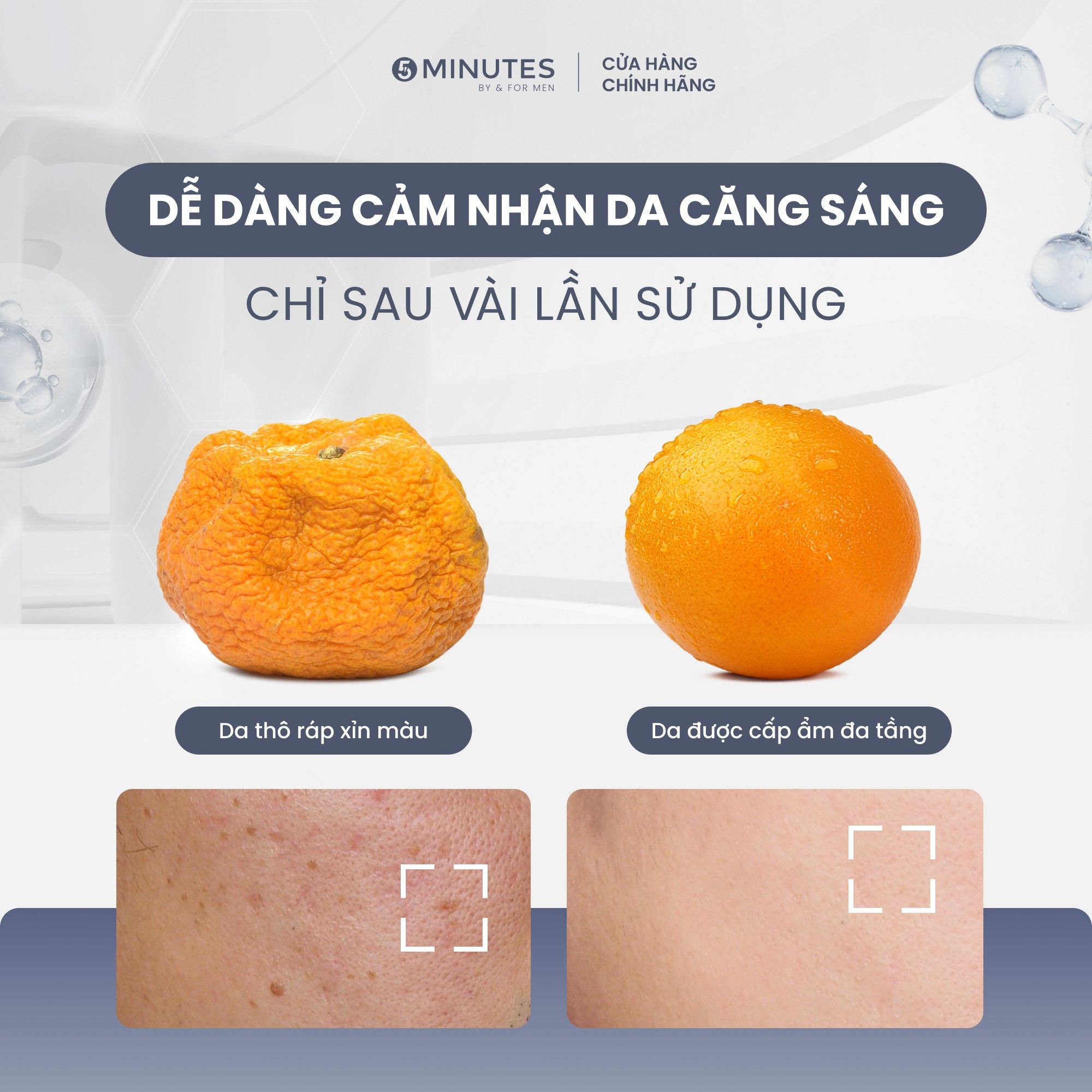  Kem dưỡng ẩm nam giới 5MINUTES Hydrating Boost 50G 