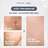  Serum cho nam giới Sáng da Cấp ẩm Phục hồi 3 trong 1 5MINUTES Tone Brightening 50ML 