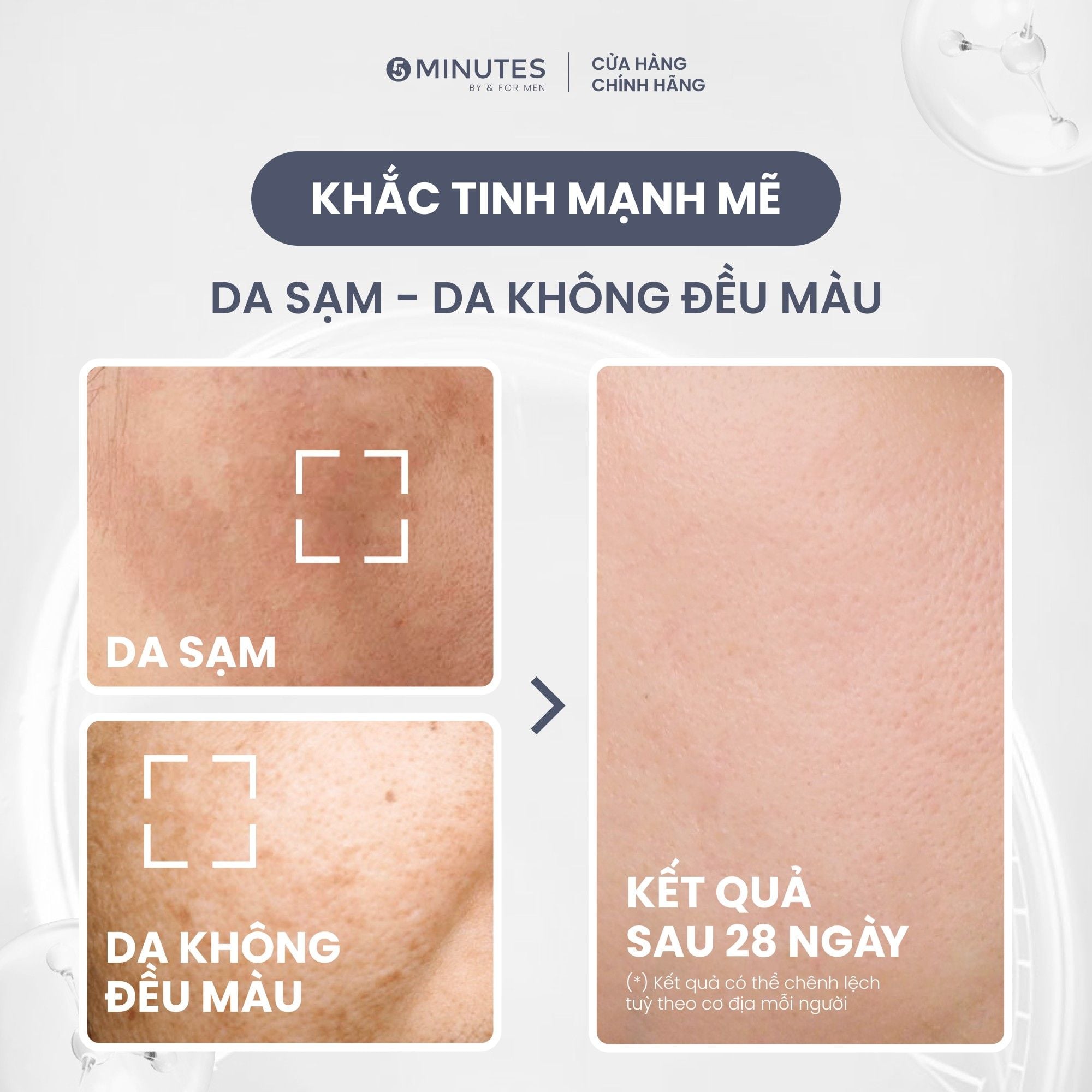  Serum cho nam giới Sáng da Cấp ẩm Phục hồi 3 trong 1 5MINUTES Tone Brightening 50ML 