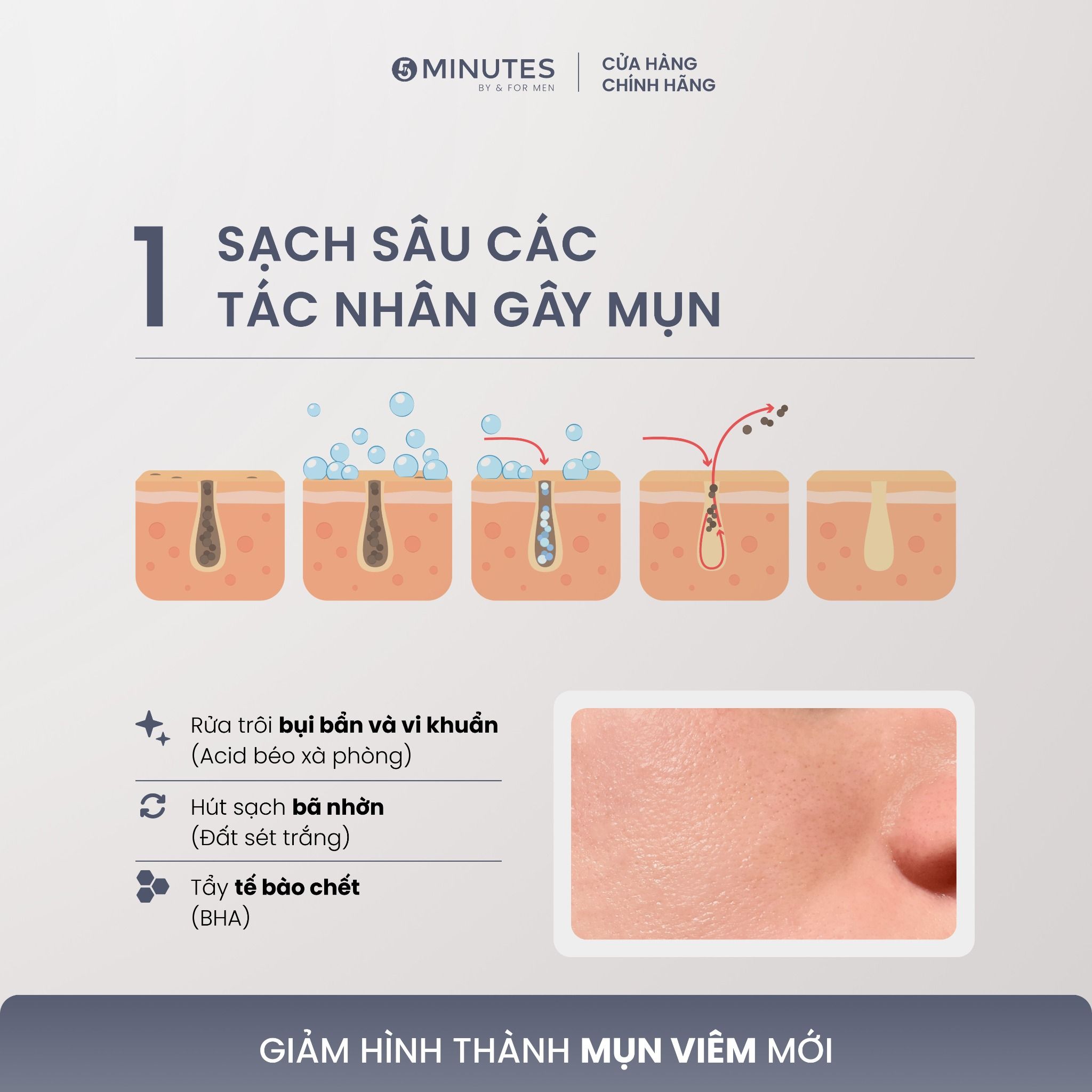 Sữa rửa mặt cho nam giới sáng da sạch sâu 5MINUTES White Extreme - 100g 