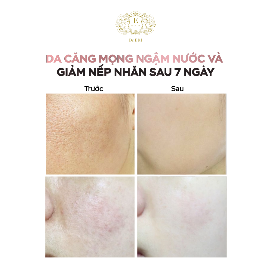  E-SPECIAL Moisture Gel 