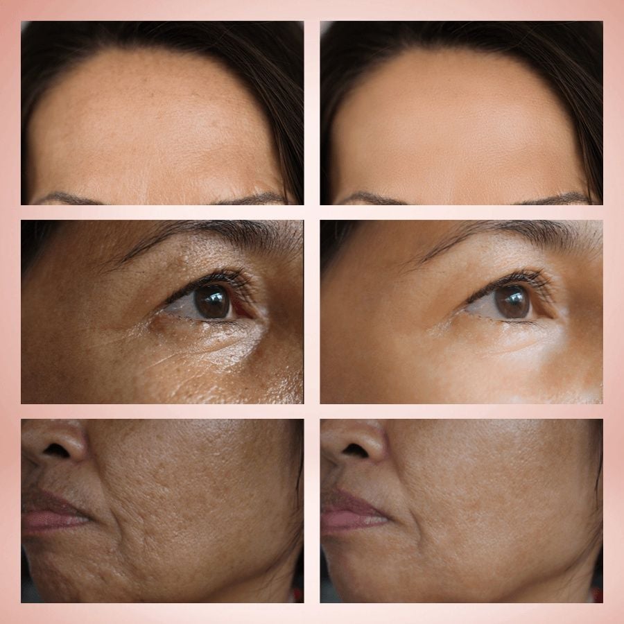 Kem dưỡng da chống lão hóa và cấp ẩm, tăng sinh collagen, trẻ hóa làn da OMUSE Secret Timeless Rejuvanting Cream 50g