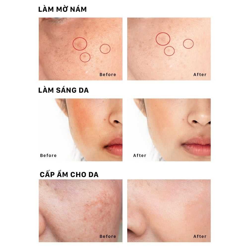 Tinh chất mờ nám và tàn nhang dưỡng trắng da OMUSE MelaV White Serum 30ml