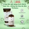  Cặp Dầu Gội Xả Gừng Detox Hỗ Trợ Mọc Tóc, Chống Lão Hóa Da Đầu Weilaiya Luxury – Dành cho da đầu khô 