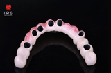  Phục hình sứ trên implant - Sứ Crom Cobalt Digital 