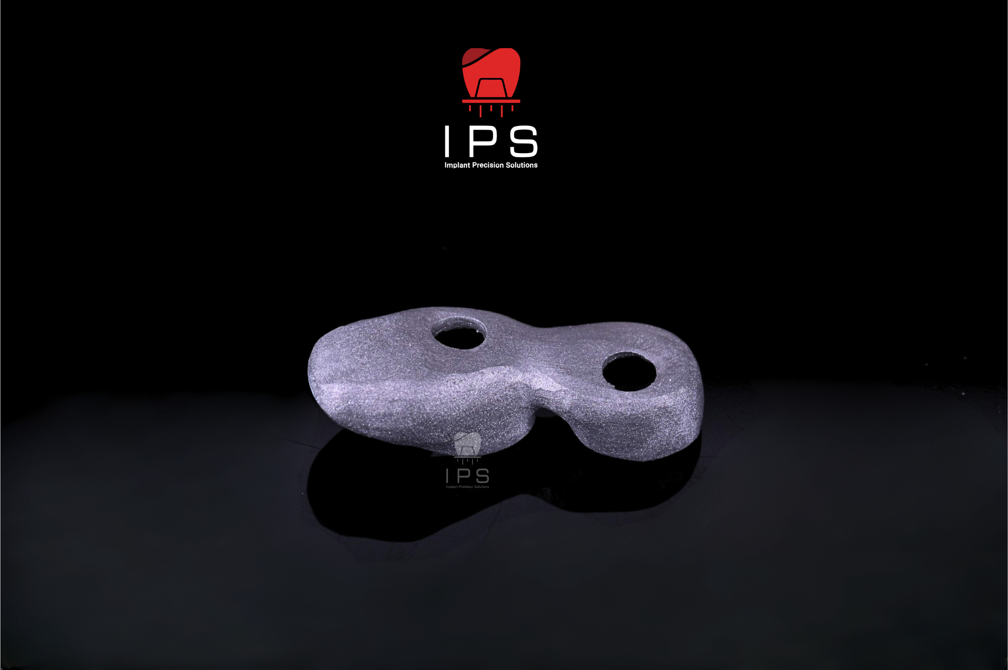  Phục hình sứ trên implant - Sứ Crom Cobalt Digital 