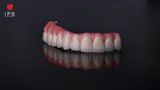  Phục hình sứ trên implant - Sứ full Zirconia 