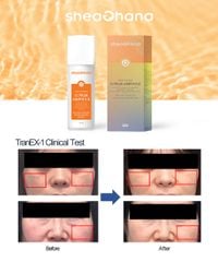 32 PIGM AMPOULE – Tinh chất chuyên sâu làm mờ thâm nám đốm nâu