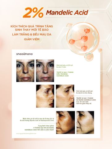 SERUM VITAMIN C – Tinh chất sáng da chống lão hóa Vitamin C