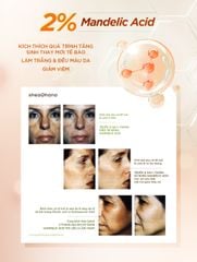 SERUM VITAMIN C – Tinh chất sáng da chống lão hóa Vitamin C