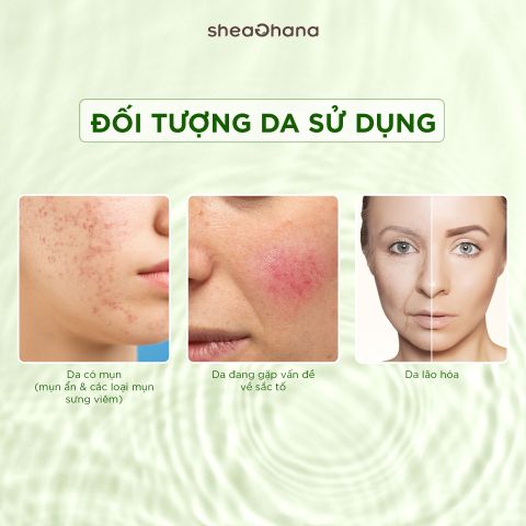 GENTLE EXFOLIATING SOLUTION 5% PHA & 10% MANDELIC ACID – Dung dịch tẩy TBC 5% PHA và 10% Mandelic Acid