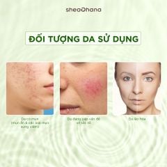 GENTLE EXFOLIATING SOLUTION 5% PHA & 10% MANDELIC ACID – Dung dịch tẩy TBC 5% PHA và 10% Mandelic Acid