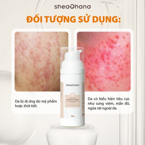 INSTANT RELIEF SKIN HEALING SERUM – Tinh chất phục hồi giảm kích ứng