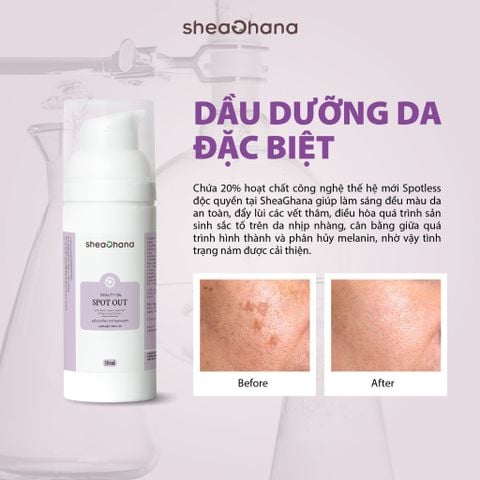 SPOT OUT BEAUTY OIL – Dầu dưỡng mờ thâm nám làm đều màu da